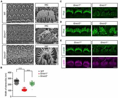 Murine GRXCR1 Has a Different Function Than GRXCR2 in the Morphogenesis of Stereocilia